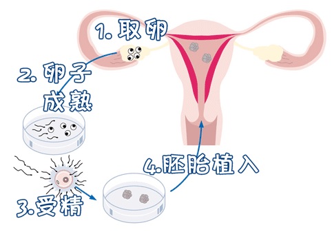 有偿同志借卵怎么选